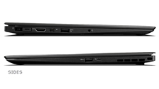 Right and Left Sides View